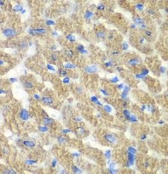 FIBP Antibody