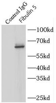 FBLN5 Rabbit Polyclonal Antibody