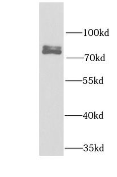 FIP1L1 Antibody