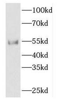 FKBP8 Rabbit Polyclonal Antibody