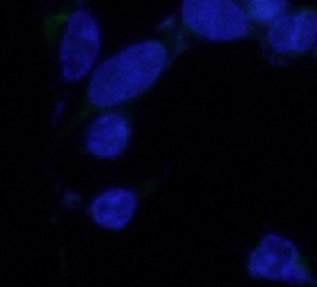 Flag tag Rabbit Polyclonal Antibody