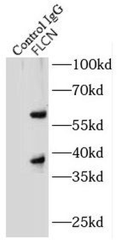 FLCN Rabbit Polyclonal Antibody