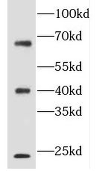 FLCN Rabbit Polyclonal Antibody