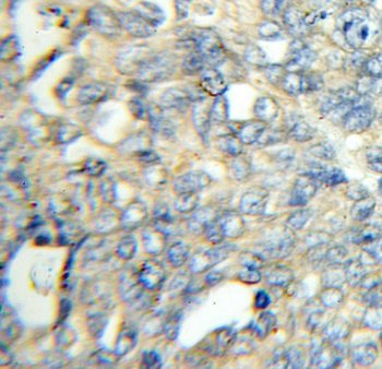 FLCN Rabbit Polyclonal Antibody