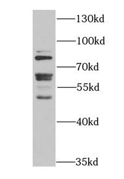 FMR1 Rabbit Polyclonal Antibody
