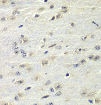FMR1 Rabbit Polyclonal Antibody