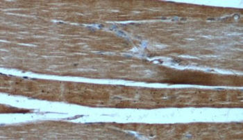 FNDC5 Rabbit Polyclonal Antibody