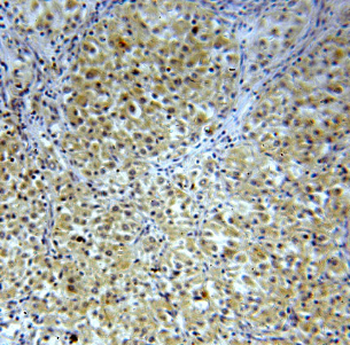FNIP1 Rabbit Polyclonal Antibody