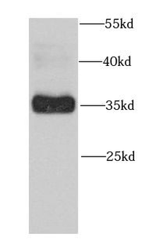 FOSL2 Rabbit Polyclonal Antibody