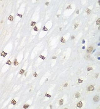 FOSL2 Rabbit Polyclonal Antibody