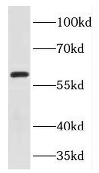 FOXG1 Rabbit Polyclonal Antibody