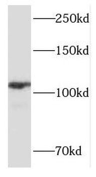 FOXM1 Antibody