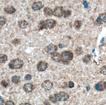FOXO6 Rabbit Polyclonal Antibody