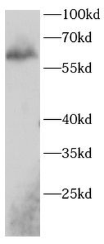 FZD2 Rabbit Polyclonal Antibody