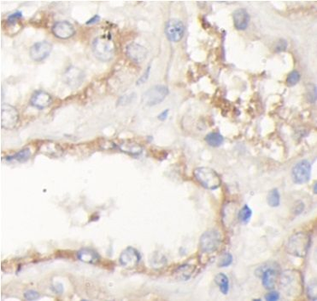 FZD2 Rabbit Polyclonal Antibody