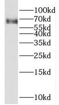 FZD7 Rabbit Polyclonal Antibody