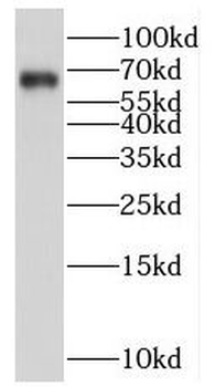 FZD9 Rabbit Polyclonal Antibody