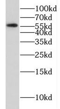 FSCN3 Rabbit Polyclonal Antibody
