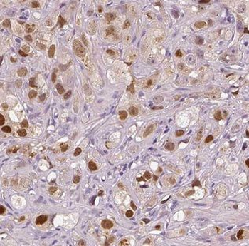 FSCN3 Rabbit Polyclonal Antibody