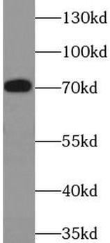 FSHR Rabbit Polyclonal Antibody