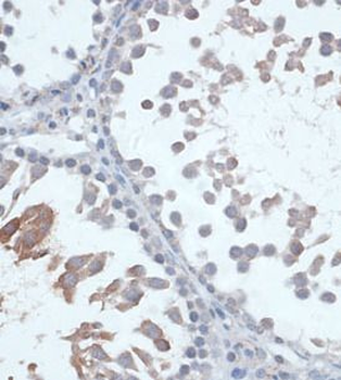 FSHR Rabbit Polyclonal Antibody