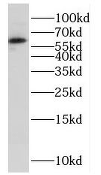 FUBP3 Rabbit Polyclonal Antibody