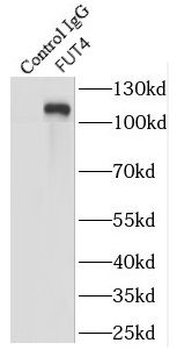 FUT4 Rabbit Polyclonal Antibody