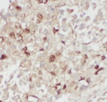 FUT4 Rabbit Polyclonal Antibody