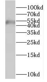 FYTTD1 Rabbit Polyclonal Antibody