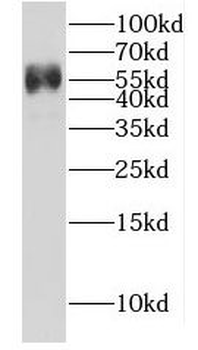 G3BP1 Rabbit Polyclonal Antibody