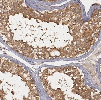 G3BP1 Rabbit Polyclonal Antibody