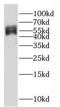 G6PD Rabbit Polyclonal Antibody