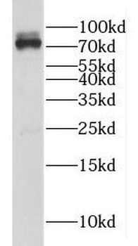 GAB2 Rabbit Polyclonal Antibody