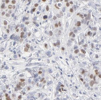 GAB2 Rabbit Polyclonal Antibody
