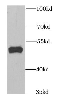 GABPB1 Rabbit Polyclonal Antibody