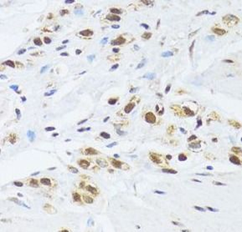 GABPB1 Rabbit Polyclonal Antibody