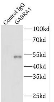 GABRA1 Rabbit Polyclonal Antibody
