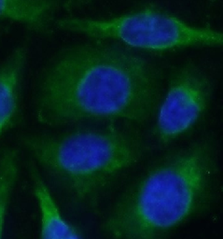 PPP1R15A Rabbit Polyclonal Antibody