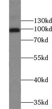 PPP1R15A Rabbit Polyclonal Antibody