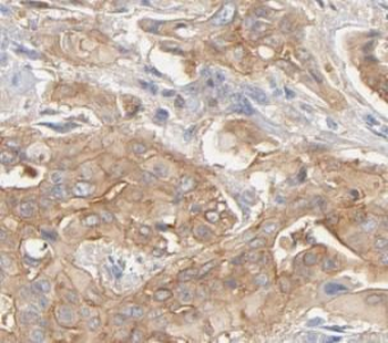 PPP1R15A Rabbit Polyclonal Antibody