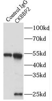 GADD45GIP1 Rabbit Polyclonal Antibody