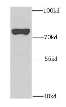 GALC Antibody