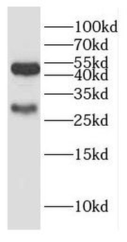 GALC Antibody