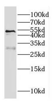 GALC Antibody