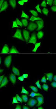 GALE Rabbit Polyclonal Antibody