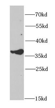 GALE Rabbit Polyclonal Antibody