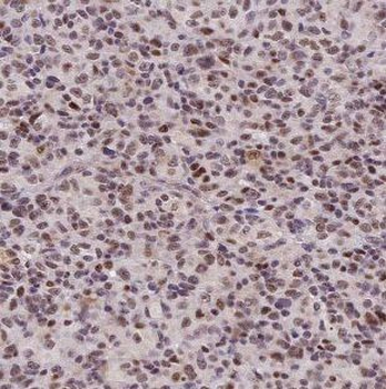 GALE Rabbit Polyclonal Antibody