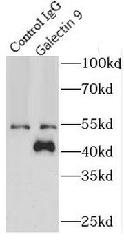 LGALS9 Antibody