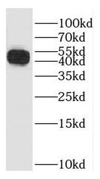 GALK1 Rabbit Polyclonal Antibody