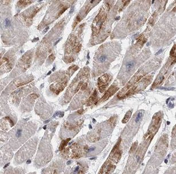 GALM Rabbit Polyclonal Antibody